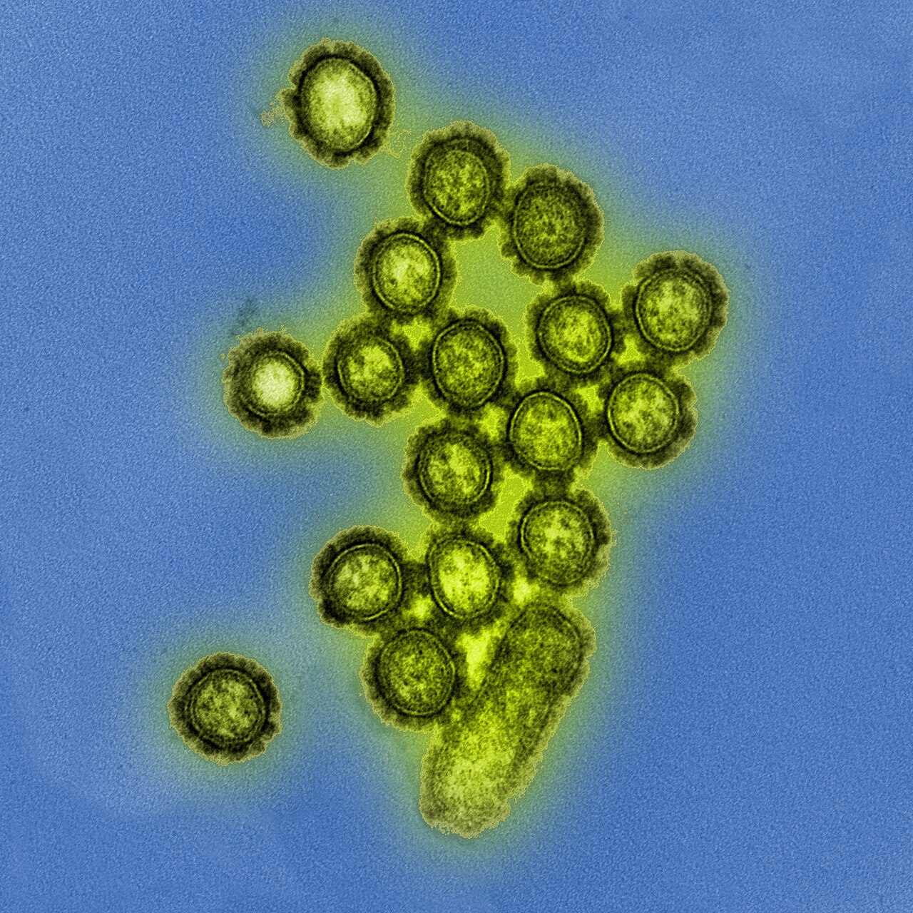 파란 배경 위에 노란빛으로 색을 입힌 H1N1 인플루엔자 바이러스 입자들이 모여 있는 전자현미경 사진입니다.